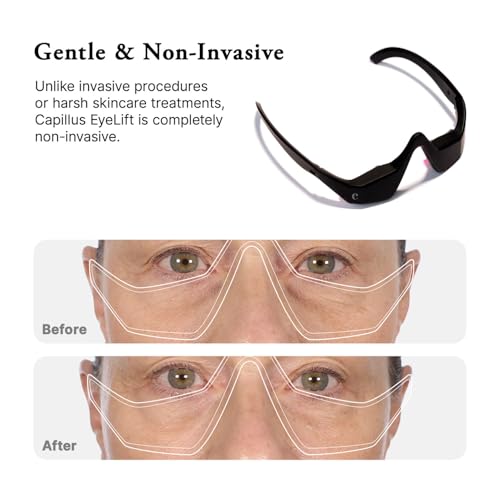 685nm Red Light Therapy Glasses for Under-Eye Care