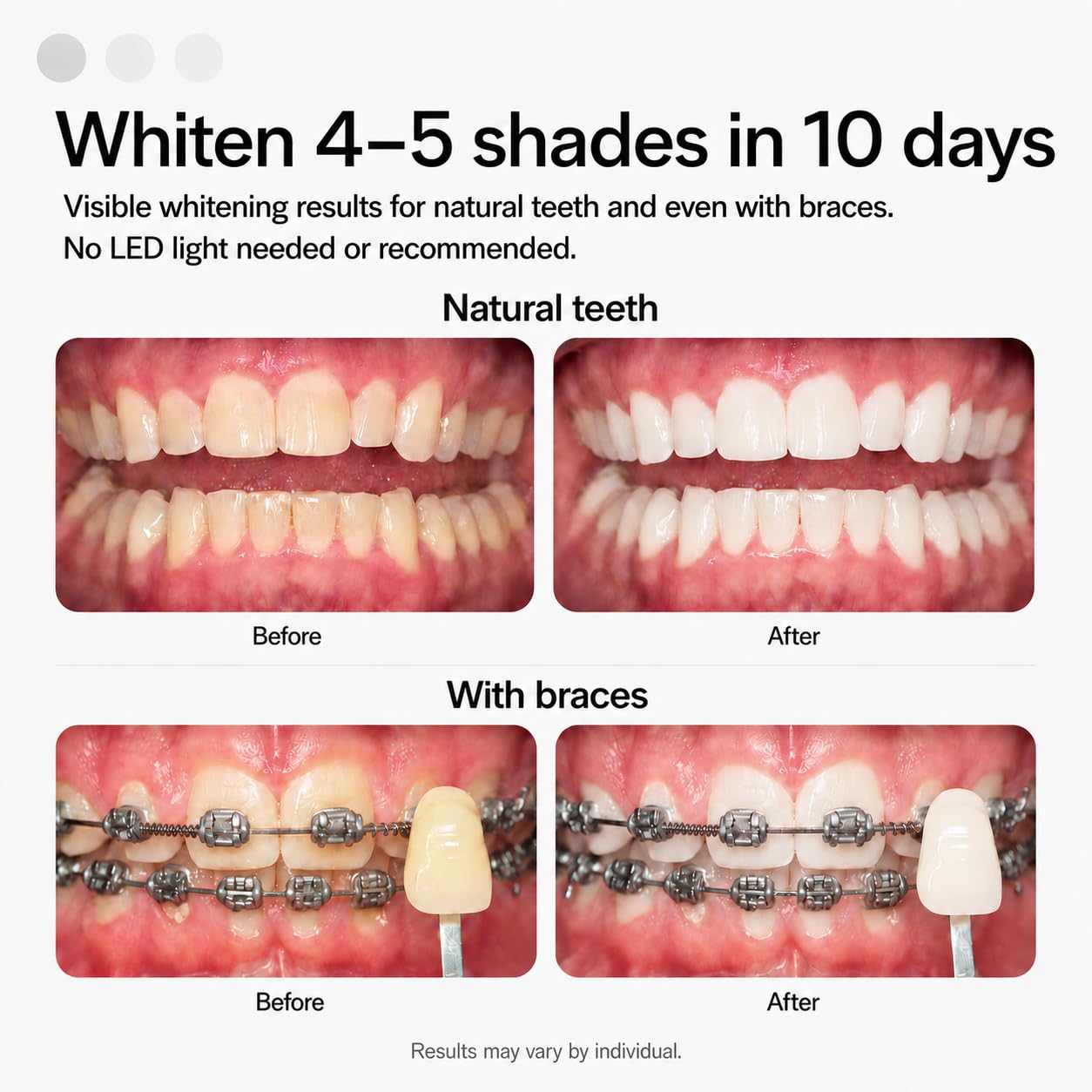 Opalescence Go Teeth Whitening Trays 15% Hydrogen Peroxide - Mint -4648-1