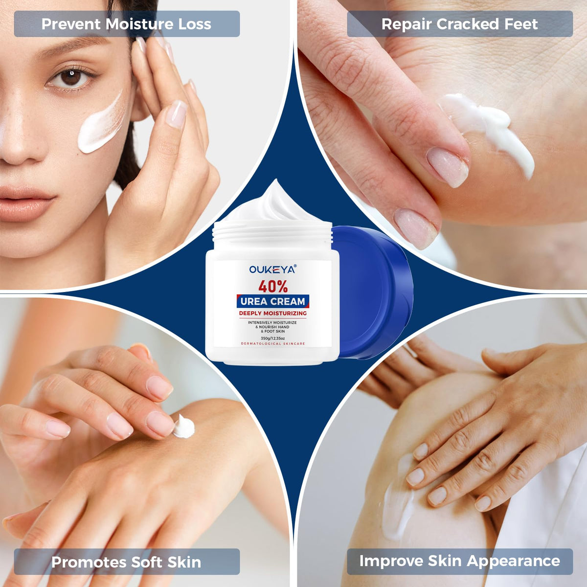40% Urea Foot & Hand Cream for Dry, Cracked Skin