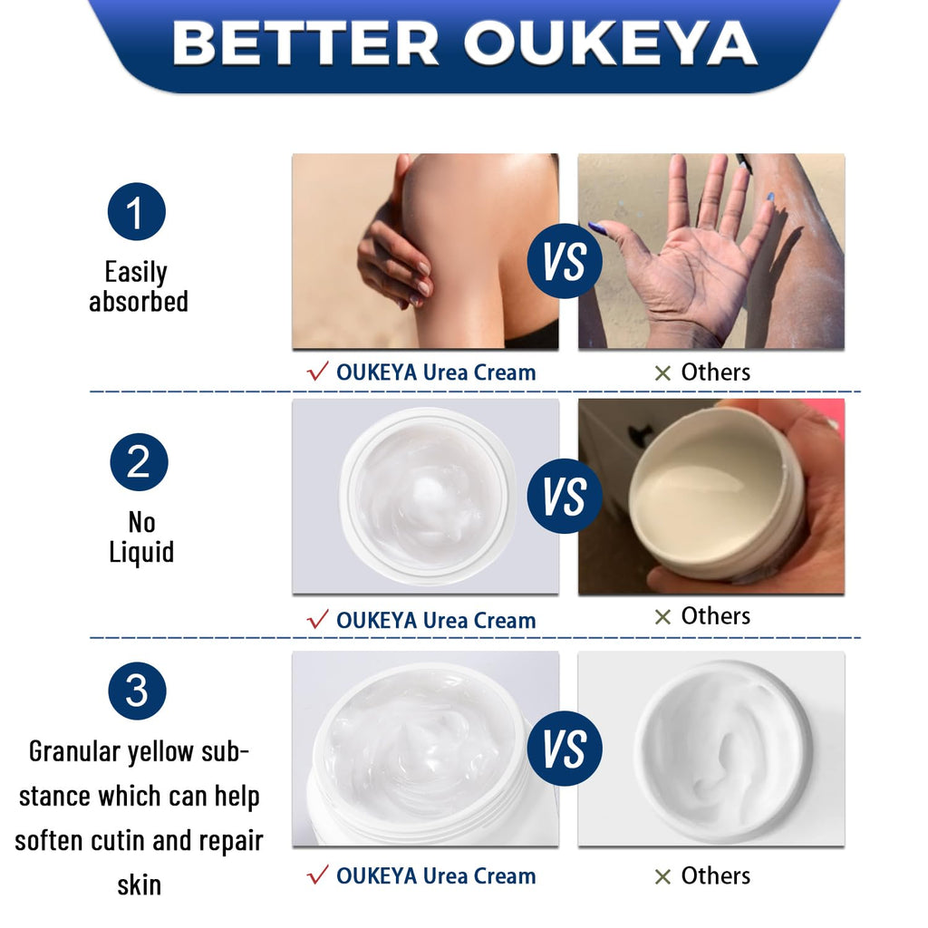 40% Urea Foot & Hand Cream for Dry, Cracked Skin